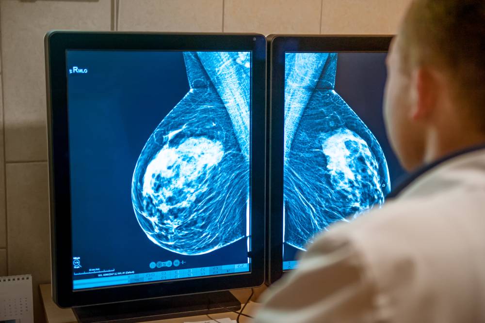 Breast Surgery
