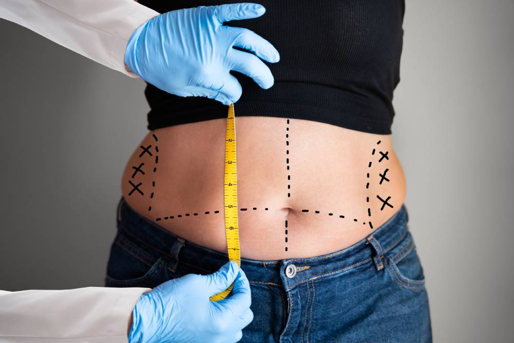 weight loss surgery