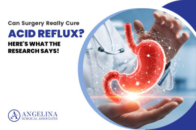 Acid Reflux