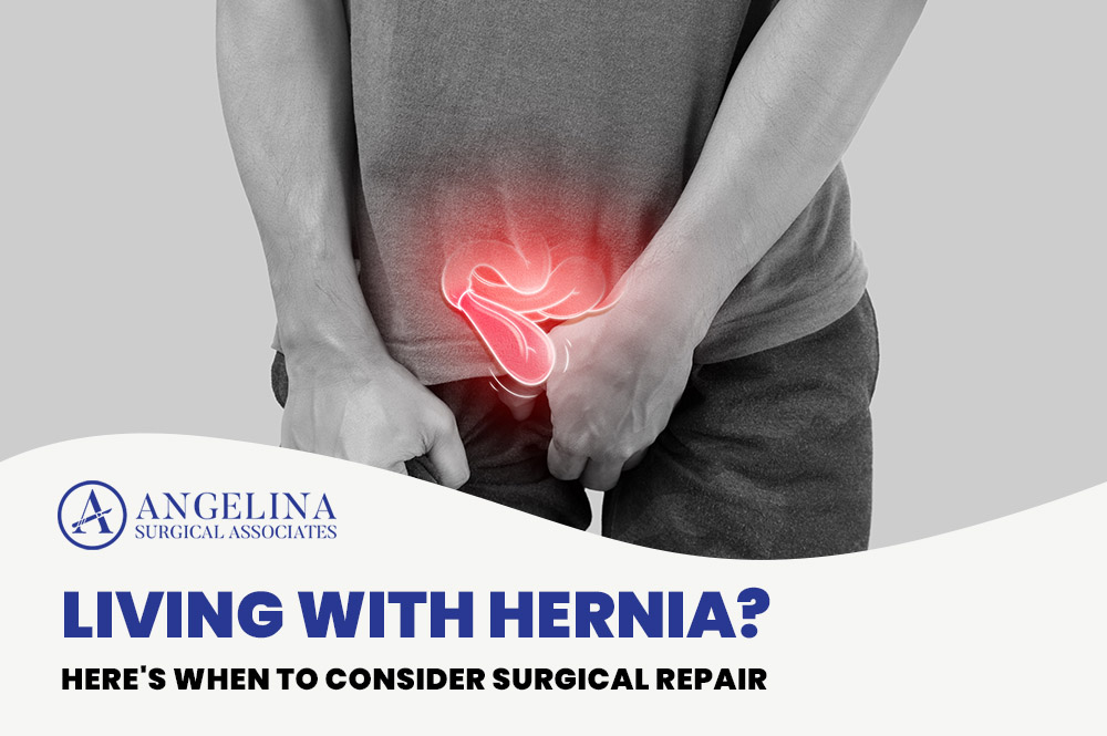 Hernia Surgical Repair