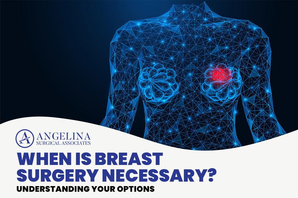 Breast Surgery
