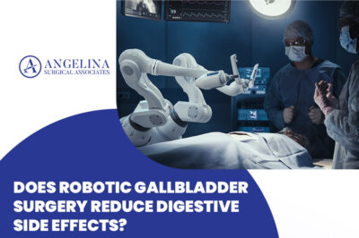 Gallbladder Surgery