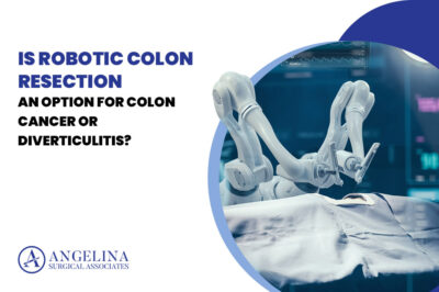 Robotic colon