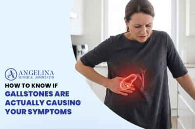 Gallstones