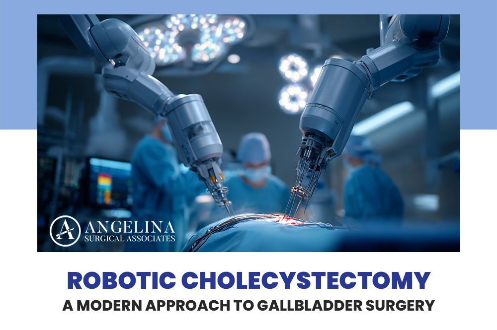Robotic Cholecystectomy